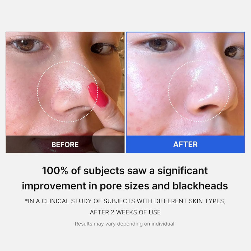 Medicube Zero Pore Pad AHA/BHA – 70 Disques (155 g)