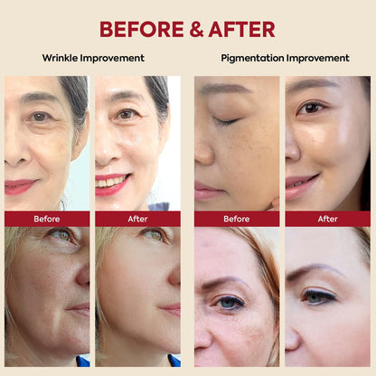 K-Secret Seoul 1988 Serum – Rétinal 2%