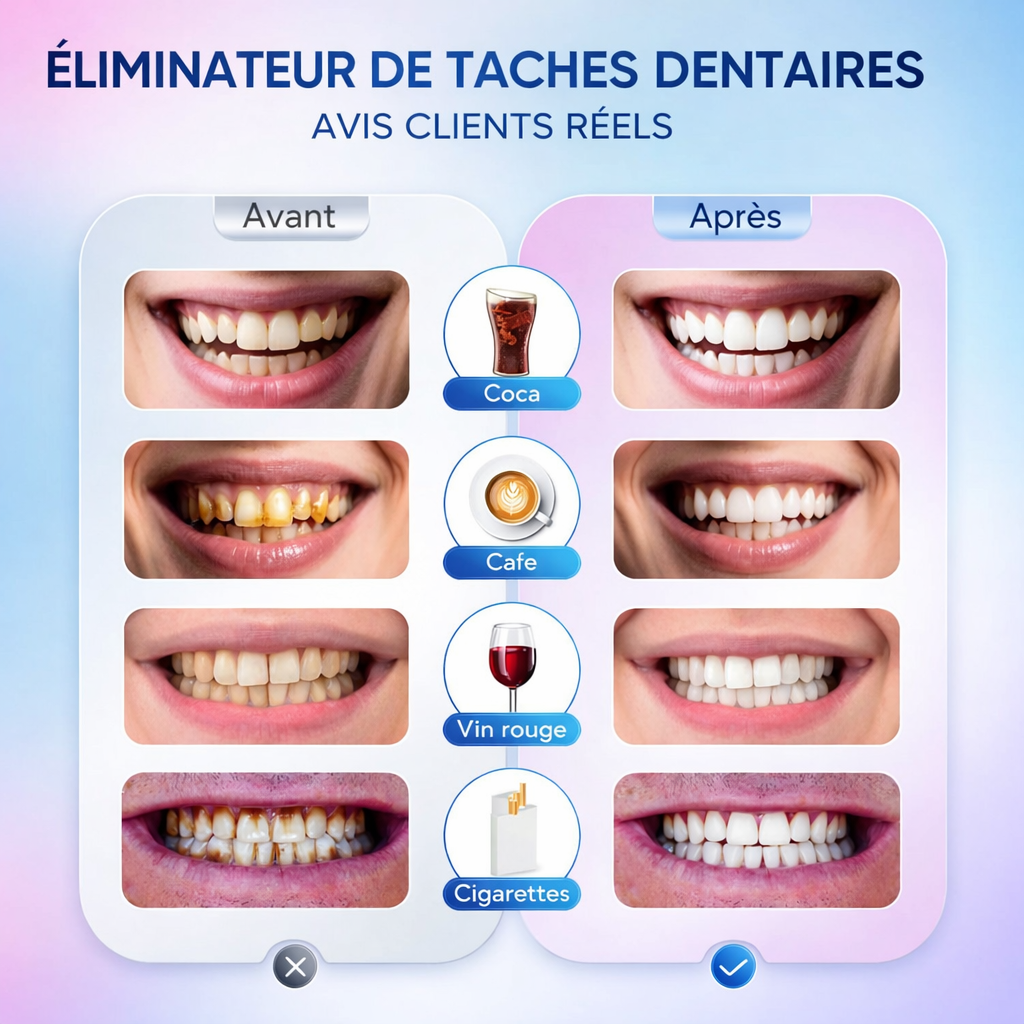 BODY ACCEL Original Solution de blanchiment dentaire