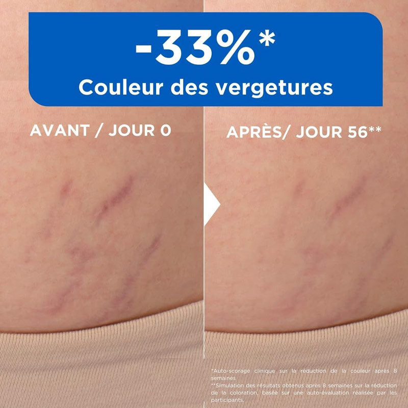 MIXA Huile Anti-Vergetures